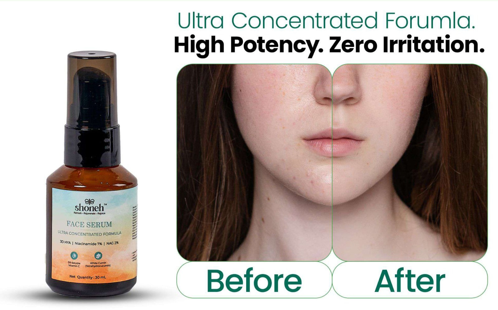 Face Serum with White Cumin and Vitamin C